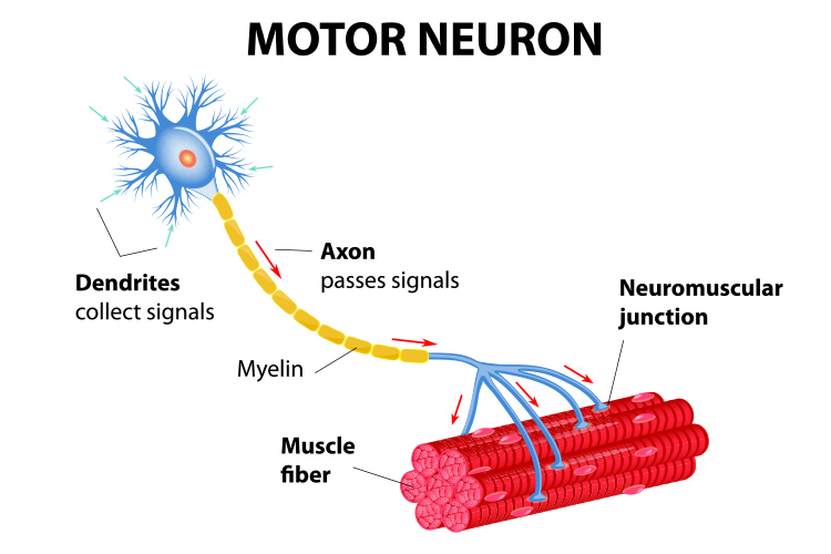 penyakit motor neuron