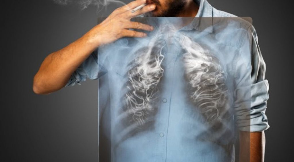 penyakit paru-paru kronis