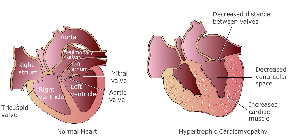 Otot Jantung